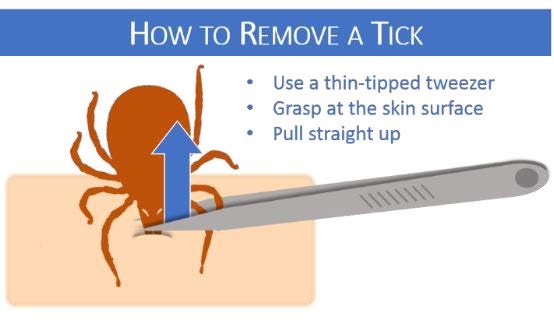 This is a figure showing how to remove a tick with the forceps close to the head of the tick.